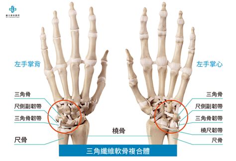 手受傷|跌倒後手腕好痛！原來是三角纖維軟骨複合體損傷